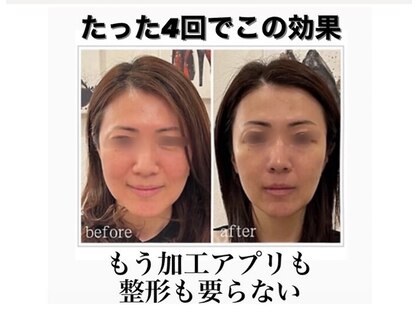 ラウレア ギンザ(Laule'a ginza)の写真