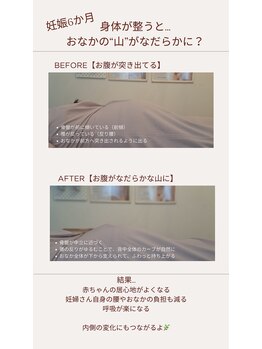 小竹向原ストレッチ整体院/おなかの“山”がなだらかに
