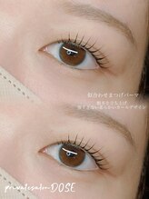 ドース(DOSE)/ビューラー卒業！