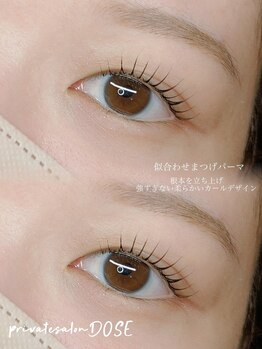 ドース(DOSE)/ビューラー卒業！