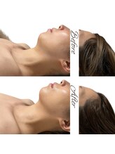 マヌレニ(manuleni)/顔は横アングルのラインも大事