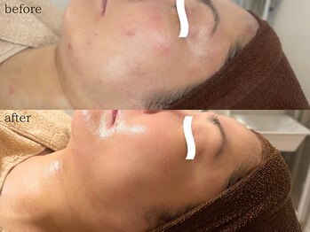 サロン モア(salon more)/ツヤ肌