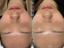 スパ ナナプラス(SPA nana+)の雰囲気（3.4月おすすめ☆《集中保湿◎光フェイシャル》お肌の水分量UP♪）