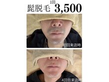 ティアレ 緑井店(Tiare)