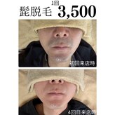 ティアレ 緑井店(Tiare)