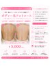 【背中・腕などのシミケア・ポツポツを何とかしたい】ボディー光フォトコース