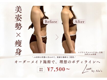 ルアバイアロ(Lua by Alo's)の写真