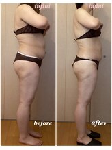 アンフィニ(infini)/短期集中コース5回目（2ヶ月）