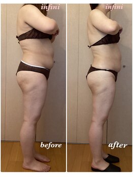 アンフィニ(infini)/短期集中コース5回目(2ヶ月)