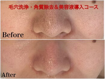 ちゅるん肌.com なかもず店