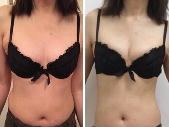 ラディス(Radice.)の写真/【バストアップ・育乳専門店】痩せ型さんも大丈夫!!根本ケアでふっくらバスト♪ボディラインのメリハリUP！