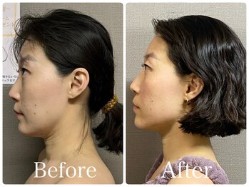 アリリン(allilin)/横顔も美人に！