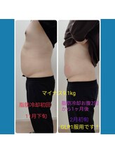 縁(en)/脂肪冷却＆リベルサス服用♪