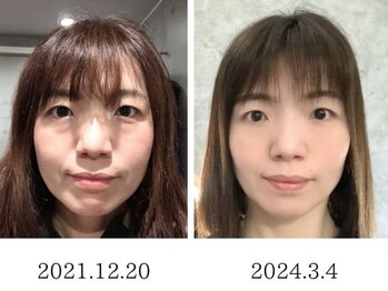 福多整体院/3年継続で印象が全然変わります