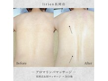 【心地良い贅沢時間】オーダーメイド施術でここまで改善します◎