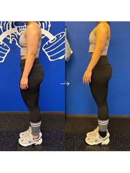 バブル(Bubble)/美尻コース60分24回