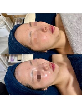 リボーン(be reborn)の写真/くすみを晴らし、「なんか今日、肌綺麗。」と言われる透明感。゛肌が明るい人゛になるだけで印象は変わる。