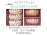 【本格的に始めたい・効果を実感したい】本気の白さ実感◎2回70分照射コース