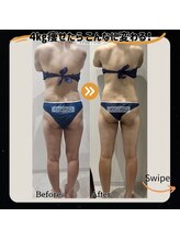 ミノ 美里大通り店(mino)/ダイエットパッケージ