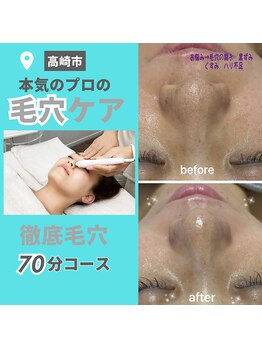 ラン(Ran)/ハイドロスプラッシュ