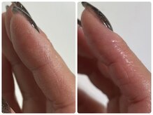 爪のいろは/乾燥繰り返す指先に…ハンドケア