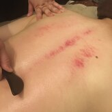 エインセル