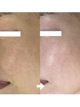 シェノン 赤坂大濠店/