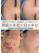 リメイクビューティークリニック(REMAKE BEAUTY CLINIC) 根本美容 肌質改善