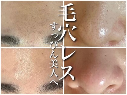 ホワイトアクア 京都店(WHITE AQUA)の写真