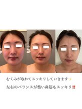 アイシー(I Sea)/小顔になりたい方はコチラ☆