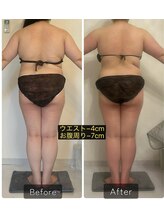 エメカシワ(Aimer KASHIWA)/1ヶ月での変化