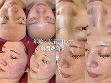 クオルーチェ(CuoLuce)