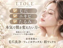 エトレ(ETOLE)