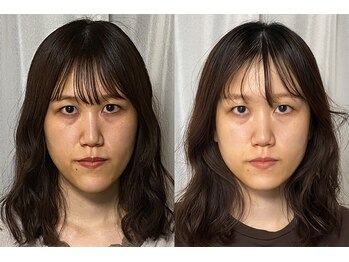 美容整体 アルマ/深層筋リンパ流し