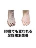 【足の痛み特化】　足指検査＋足指矯正　¥8,000⇒¥2,980