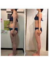 骨盤ストレッチ整体 b/姿勢改善×ハイパーナイフ