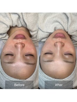 ムゥ(Mwoo)/ララピール/ララピール西宮