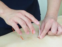 プラネット鍼灸整骨院