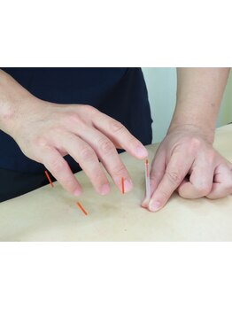 鍼灸施術を受けたい