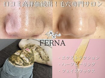 フェルナ(FERNA)