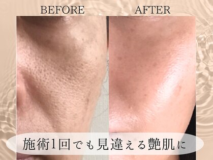 ルミナス(luminous)の写真