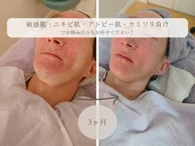 コンフィルーム(comfy room)の雰囲気（メンズも歓迎！リラックスして受けられます♪）