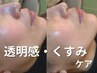 【たるみ毛穴・くすみに】ダクトピール+幹細胞導入