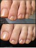 【フットケア】足元トータルケアコース 