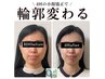 【小顔矯正+美肌美顔器4回モニターコース】通常46,000円→モニター24,000円