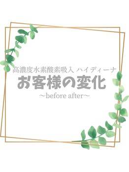 ヨサパーク マナ(YOSA PARK MANA)/～お客様の変化～