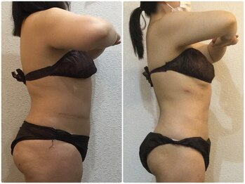 美容整体 ウェリナ 蟹江院/小顔矯正/骨盤矯正/美脚サロン