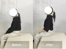 ナオル整体 国分寺院(NAORU整体)/施術【猫背矯正】