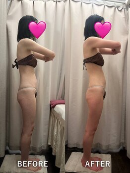 ベルミーランド MEGAドン・キホーテ草加/痩身Before→After