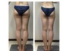 【脚ダイエット専門】太もも-7cm症例あり セルライト改善痩身体験 60分¥4980